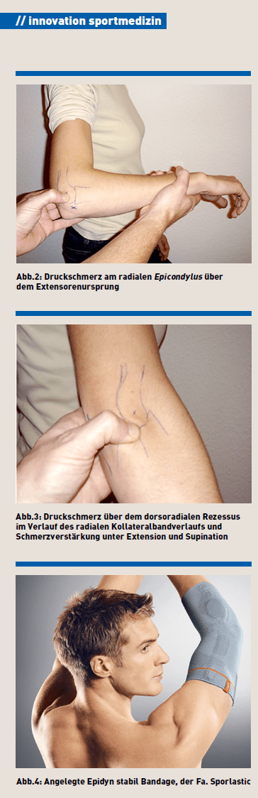 Bilder-in-Artikel-Stabilisierende-Ellenbogenbandage