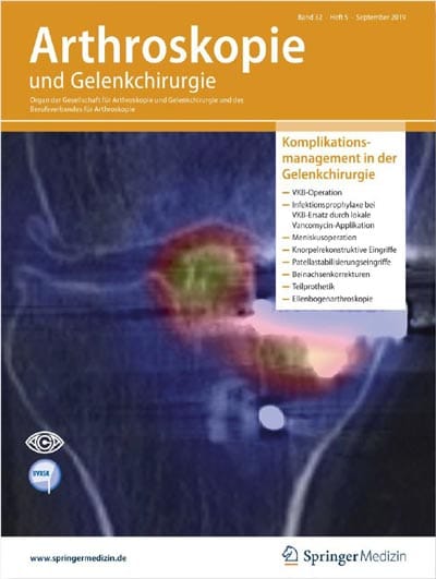 Übersichtsartikel „Lösungen für häufige Komplikationen bei Patella-Stabilisierungseingriffen“ - Arthroskopie Ausgabe 5/2019