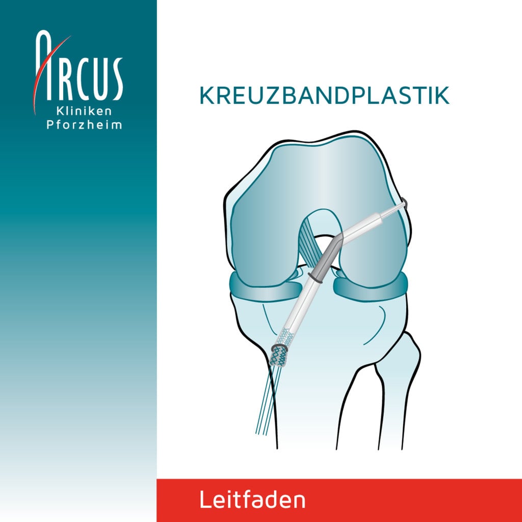 Behandlungsleitfaden Kreuzbandplastik